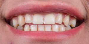 Достижения в области эстетической стоматологии